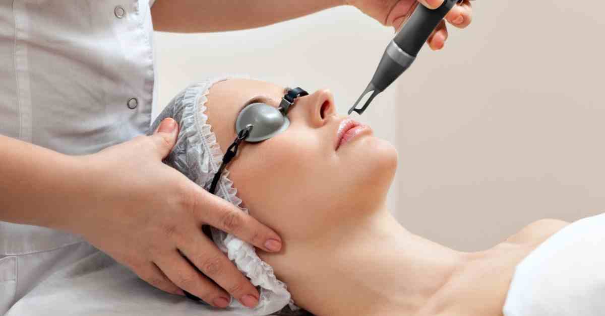 Laser trị mụn