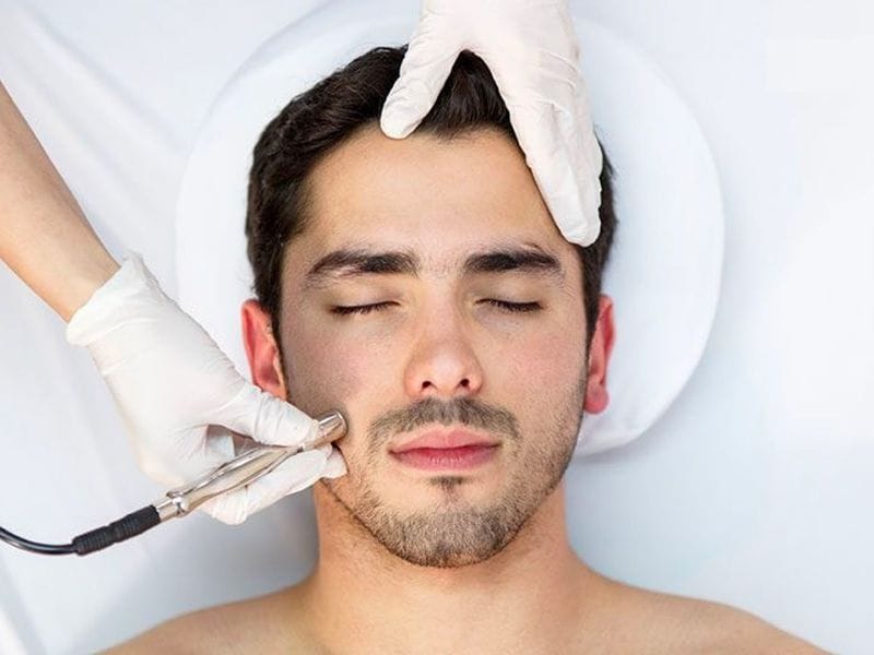 Trị Mụn Nam Bằng Các Phương Pháp Công Nghệ