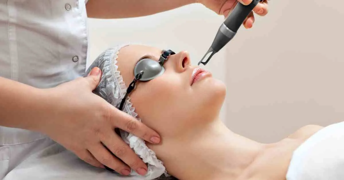 Laser trị mụn