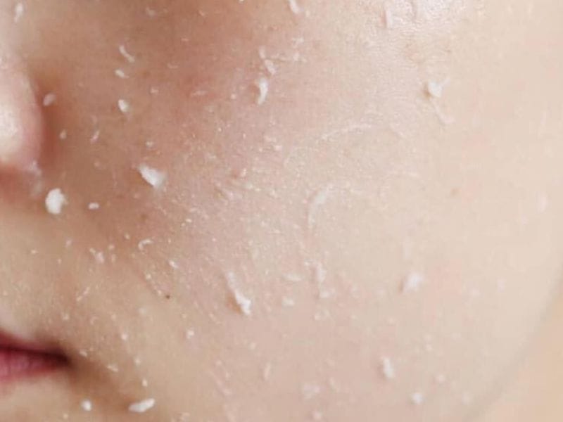 Tẩy tế bào chết định kỳ